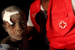 Injured Child in Port-au-Prince (Photo:American Red Cross)